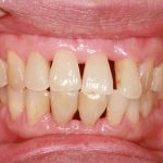 Do You Need to See a Periodontist? Here's How You'll Know