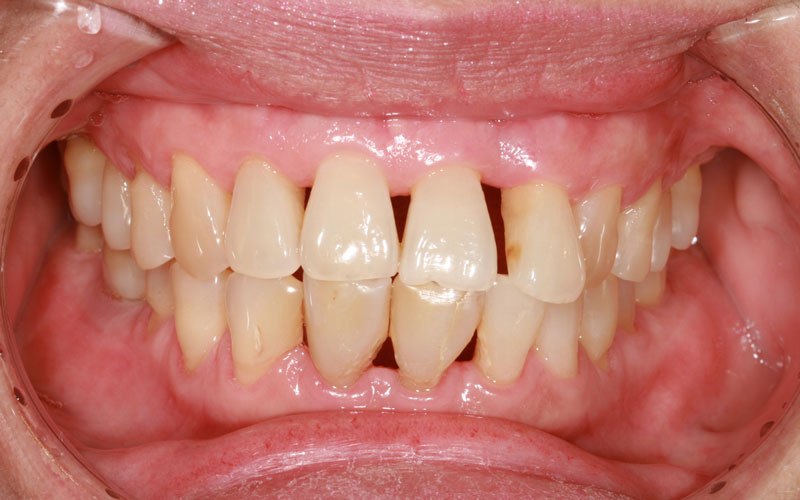 Do You Need to See a Periodontist? Here's How You'll Know